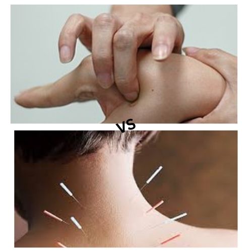 Acupressure vs Acupuncture