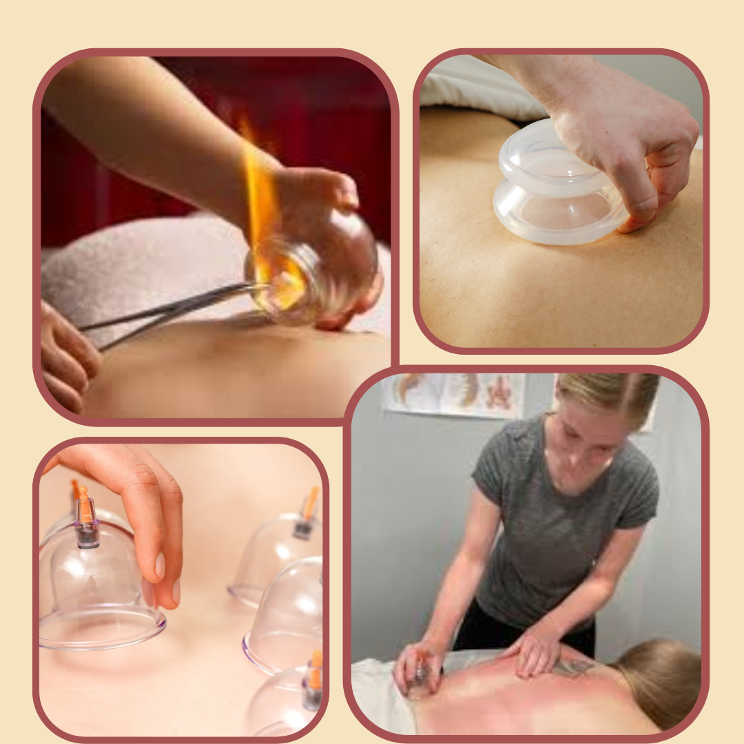 Ventosa Massage (Cupping Therapy)