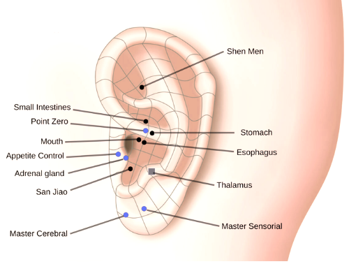 Auricular treatment for weight loss